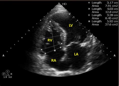 2d echo validity period